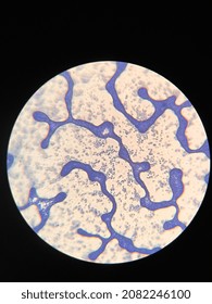 Microscopic Photo Of Gram Positive Bacteria On Slide