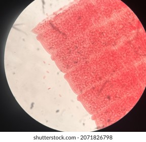 Microscopic Photo Of Tape Worm Segments