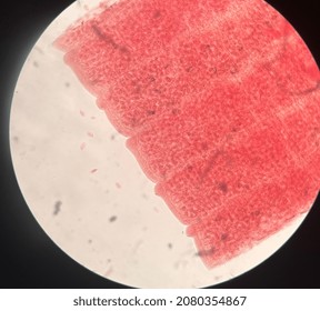 Microscopic Photo Of Tape Worm Segments