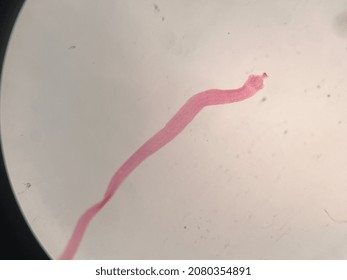 Microscopic Photo Of Tape Worm Segments