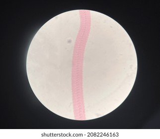 Microscopic Photo Of Tape Worm Segments