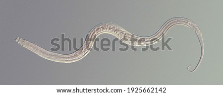 
Microscopic photograph of a nematode colored under a phase contrast microscope
