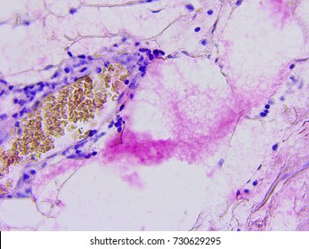 Microscopic Photography Of Mucous Membrane Of The Appendix, Color Test For Enzymes, Positive Mucus