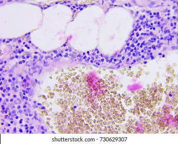 Microscopic Photography Of Mucous Membrane Of The Appendix, Color Test For Enzymes, Positive Mucus