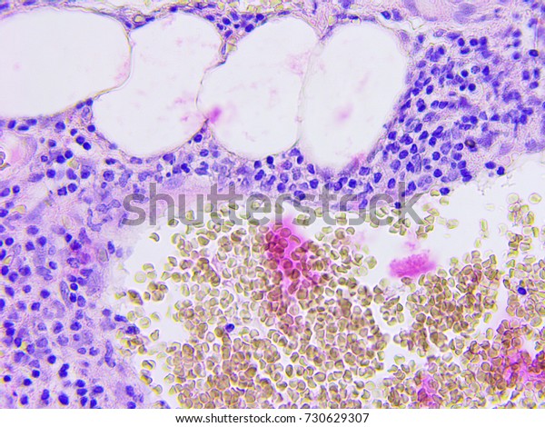 Microscopic Photography Mucous Membrane Appendix Color Stock Photo ...