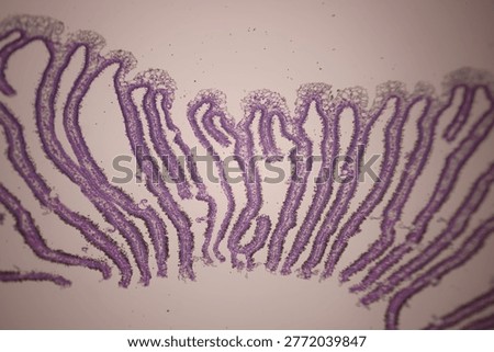 Microscopic section of tissue stained in purple showing long, folded protrusions, cellular patterns, and large open spaces