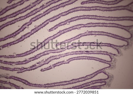Microscopic section of tissue stained in purple showing long, folded protrusions, cellular patterns, and large open spaces