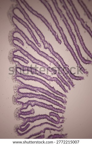 Microscopic section of tissue stained in purple showing long, folded protrusions, cellular patterns, and large open spaces