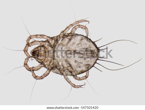 microscopic shot showing a\
house dust mite