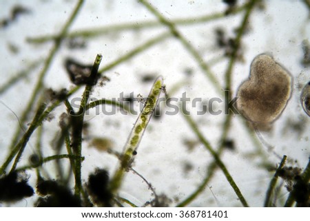 Microscopic single cell animals found in a fresh water duck pond as seen through a microscope at magnification 100X photographed with a DSLR Camera. Microbiology and Science.