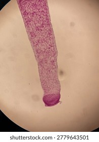 Microscopic Stained Specimen of Hydra Polyp Showing Budding and Tentacles