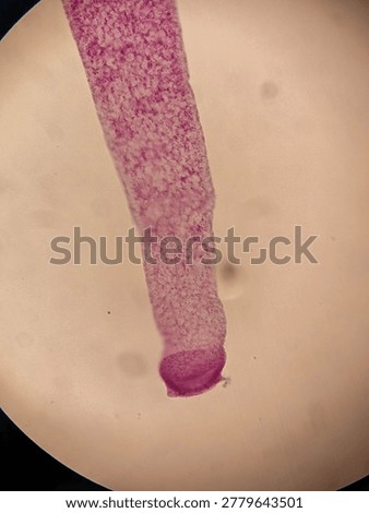 Microscopic Stained Specimen of Hydra Polyp Showing Budding and Tentacles