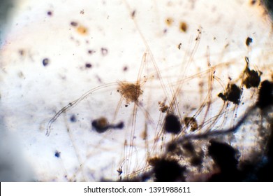 Microscopic View Aspergillus Mold Hyphae Stock Photo (Edit Now) 1391988611