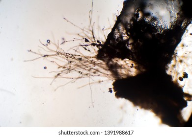 Microscopic View Aspergillus Mold Hyphae Stock Photo (Edit Now) 1391988617