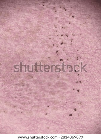 Microscopic view of biological tissue displaying a pinkish-purple cellular structure with scattered dark brown particles, suggesting a scientific or medical sample