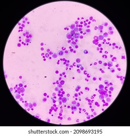 Early myelocyte Images, Stock Photos & Vectors | Shutterstock