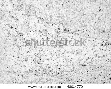 Microscopic view of the Curd seen from the microscope. The Lactobacillus Bacteria. The Science education. Macro. Close up. 