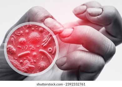 Microscopic View of Dirty Female Hands. - Powered by Shutterstock