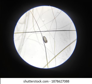 Flea Microscope Images Stock Photos Vectors Shutterstock