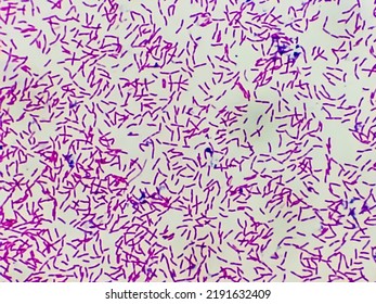 Microscopic View Gram Stain Showing Rod Stock Photo 2191632409 ...