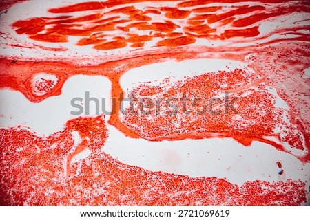 Microscopic view of human bone marrow showing clusters of red blood cells, trabecular bone structure, and stained connective tissue.