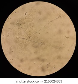 Microscopic view of hyphae of dermatophytes. fungus test. skin scraping, Diagnosis for fungal infection.