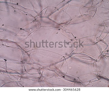 A microscopic view of the leaf surface showing plant cells.