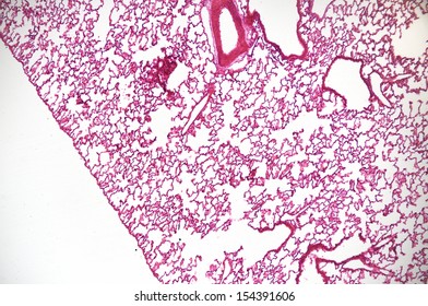 Microscopic View Of Lung Tissue