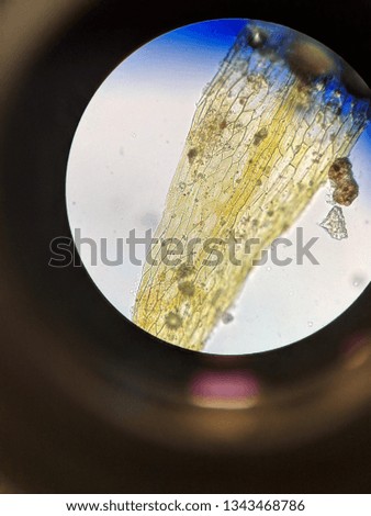 Microscopic View of Moss Leaf