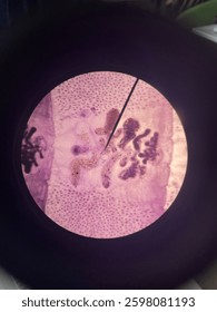 Microscopic view of a prepared slide containing a Diphyllobothrium latum, taenia saginata and taenia solium. Frequently used in parasitology, medical research, and disease studies.