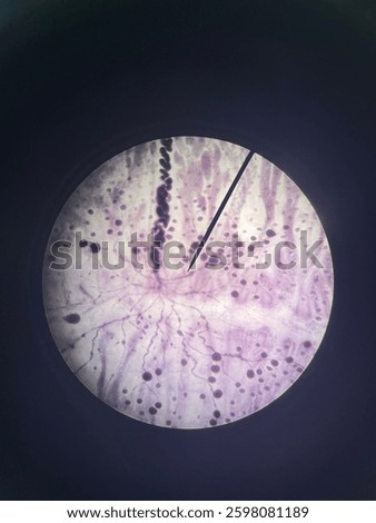 Microscopic view of a prepared slide containing a Diphyllobothrium latum, taenia saginata and taenia solium. Frequently used in parasitology, medical research, and disease studies.