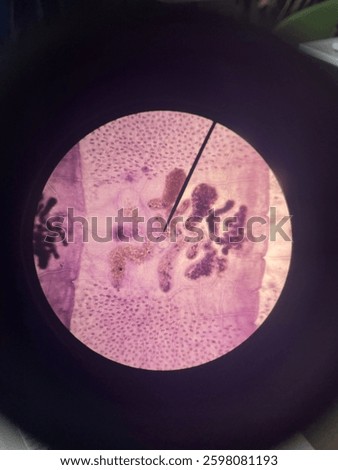 Microscopic view of a prepared slide containing a Diphyllobothrium latum, taenia saginata and taenia solium. Frequently used in parasitology, medical research, and disease studies.