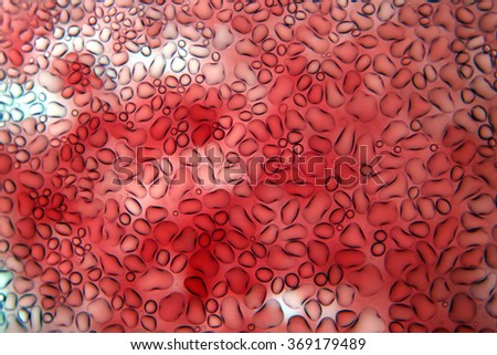 Microscopic view of Red and White Human Blood Cells seen at 10x with water droplets on top of the glass slide covering the blood. Photo taken through a biological microscope with a DSLR Camera. 