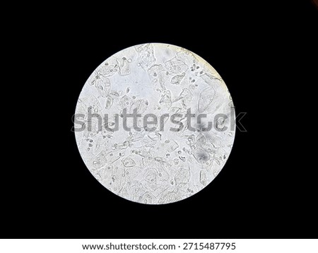 Microscopic view of squamous epithelial cells in human urine sediment. High magnification showing cell structure and nuclei for medical diagnosis and clinical laboratory analysis.

Keywords language: 