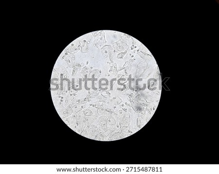 Microscopic view of squamous epithelial cells in human urine sediment. High magnification showing cell structure and nuclei for medical diagnosis and clinical laboratory analysis.

Keywords language: 