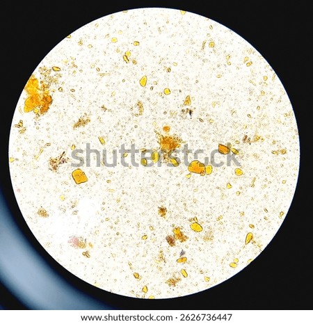 Microscopic view of stool analysis showing Muscle fibers.