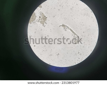 Microscopic view of stool examination at 40X magnification showing giardia lamblia cyst.
