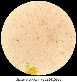 Microscopic view of stool sample showing Cyst of Entamoeba histolytica, Medical and health care concept