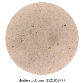 Microscopic view of stool sample showing Cyst of Entamoeba histolytica, Medical and health care concept