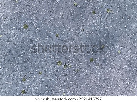 Microscopic view of stool sample showing Cyst of Entamoeba histolytica, Medical and health care concept