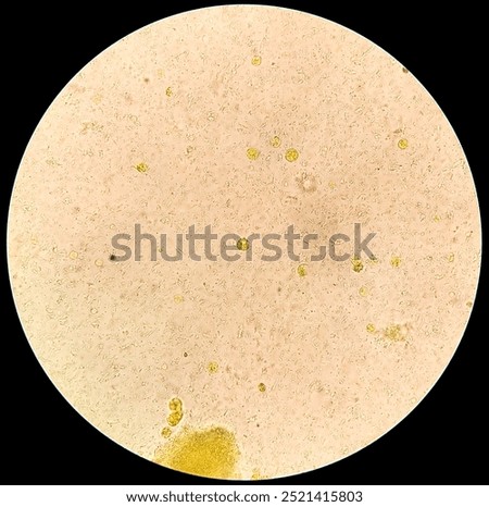 Microscopic view of stool sample showing Cyst of Entamoeba histolytica, Medical and health care concept