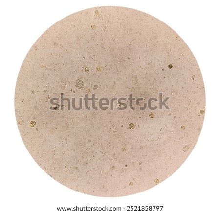 Microscopic view of stool sample showing Cyst of Entamoeba histolytica, Medical and health care concept
