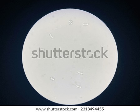 Microscopic view of struvite crystals from urinary sediment. Magnesium ammonium phospate crystals. Causing Feline Lower Urinary Tract Disease
