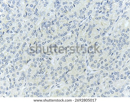 Microscopic view of tissue with numerous cells, stained for analysis, showing nuclei and cytoplasm