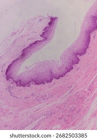Microscopic view of tissue with purple staining, showing cellular structures and patterns, likely related to biological or medical research