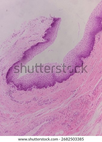 Microscopic view of tissue with purple staining, showing cellular structures and patterns, likely related to biological or medical research