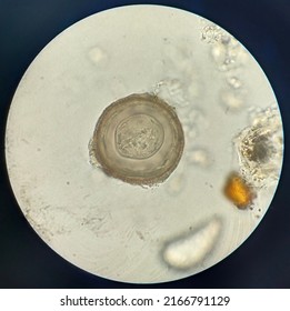 Microscopic(100x) of Hymenolepis diminuta,rat tapeworm in human feces,stool examination.