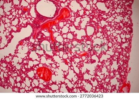 Microscopically stained section of lung tissue showing alveolar spaces, branching red blood vessels, and cellular structures.