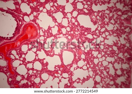 Microscopically stained section of lung tissue showing alveolar spaces, branching red blood vessels, and cellular structures.