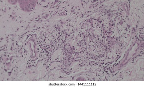 Microscopy Of Cytopathology Slides And Histopathology. Slides Of Cytopathology.